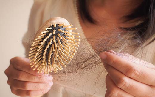 5 Facts To Help You Cope With Alopecia